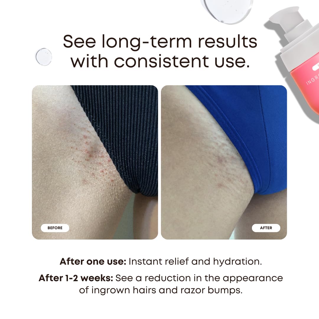 Exfoliante de Sandía de Bushbalm en envase de 236 ml para piel suave.