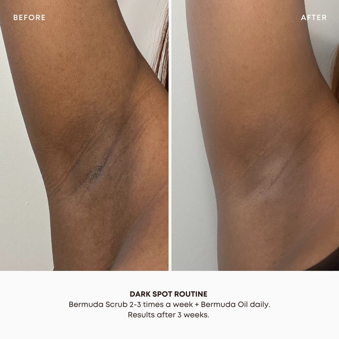 Ingredientes naturales: jojoba, árbol de té y limón para piel sensible.