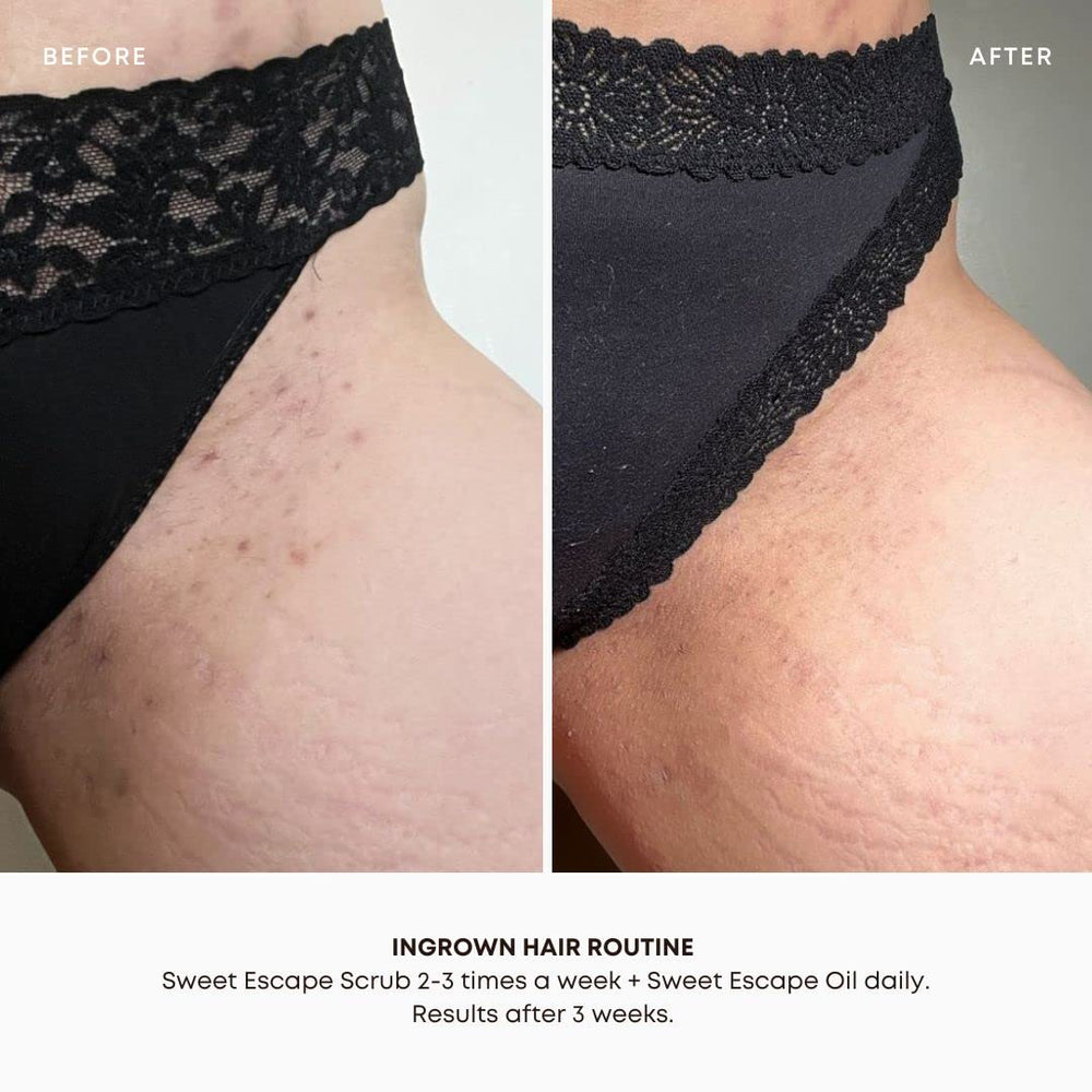 Ingredientes naturales de Bushbalm: jojoba y árbol de té cuidan la piel.