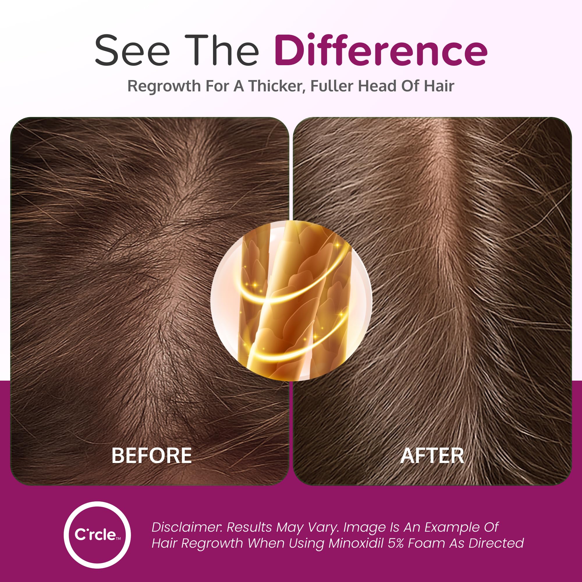 C'rcle Minoxidil 5% cabello crecimiento.