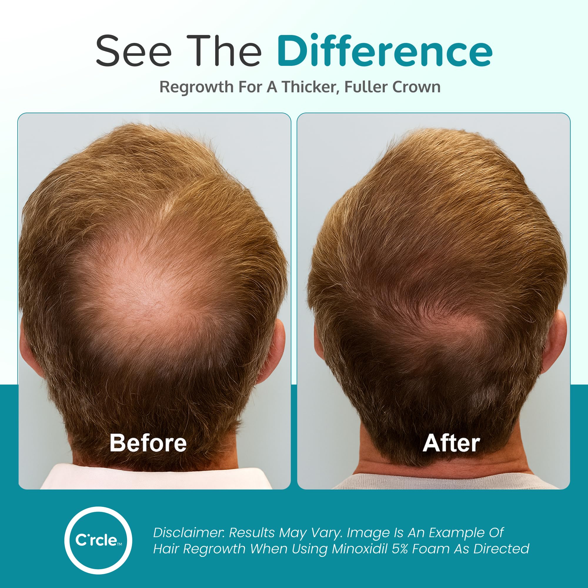 C'rcle Minoxidil Foam 5% absorción fácil y distribución uniforme.