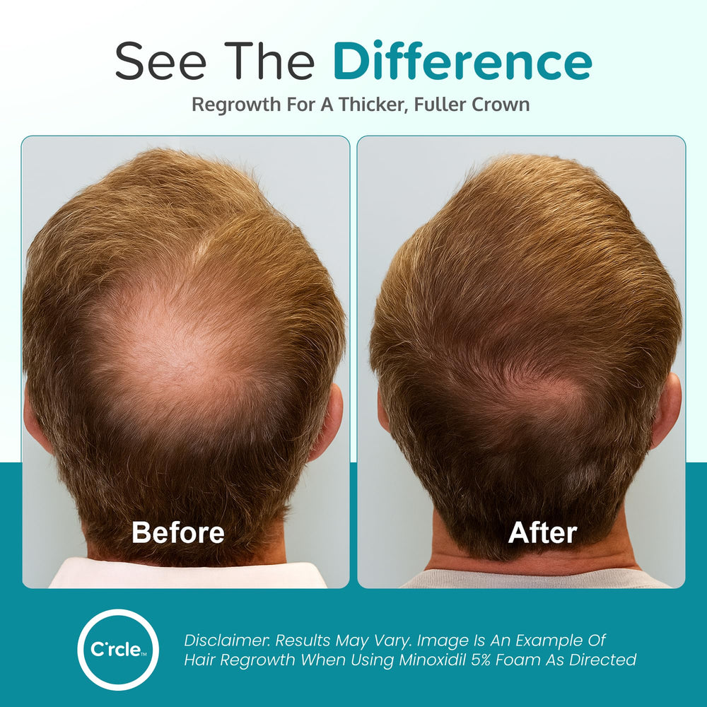 C'rcle Minoxidil Foam 5% absorción fácil y distribución uniforme.