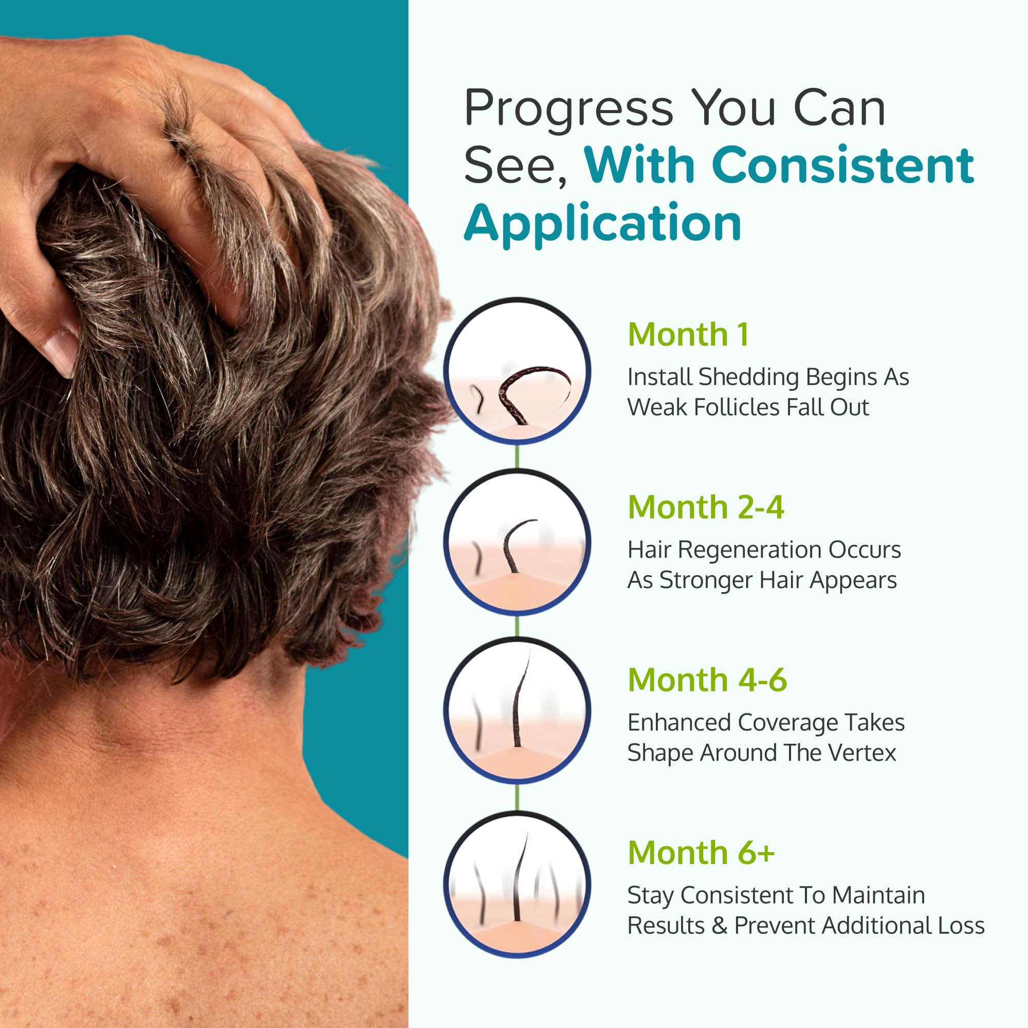 C'rcle Minoxidil Foam 5% cobertura uniforme en áreas afectadas.