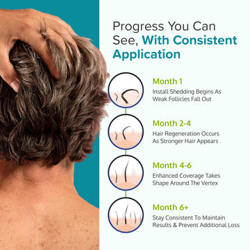 C'rcle Minoxidil Foam 5% cobertura uniforme en áreas afectadas.