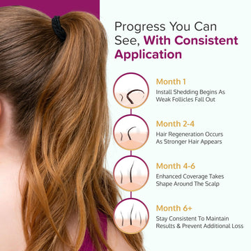 C'rcle Mujer usando Minoxidil: rutina diaria.