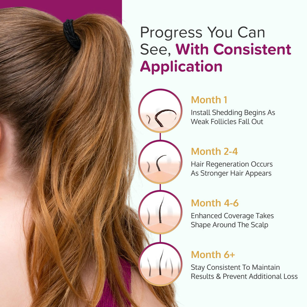 C'rcle Mujer usando Minoxidil: rutina diaria.