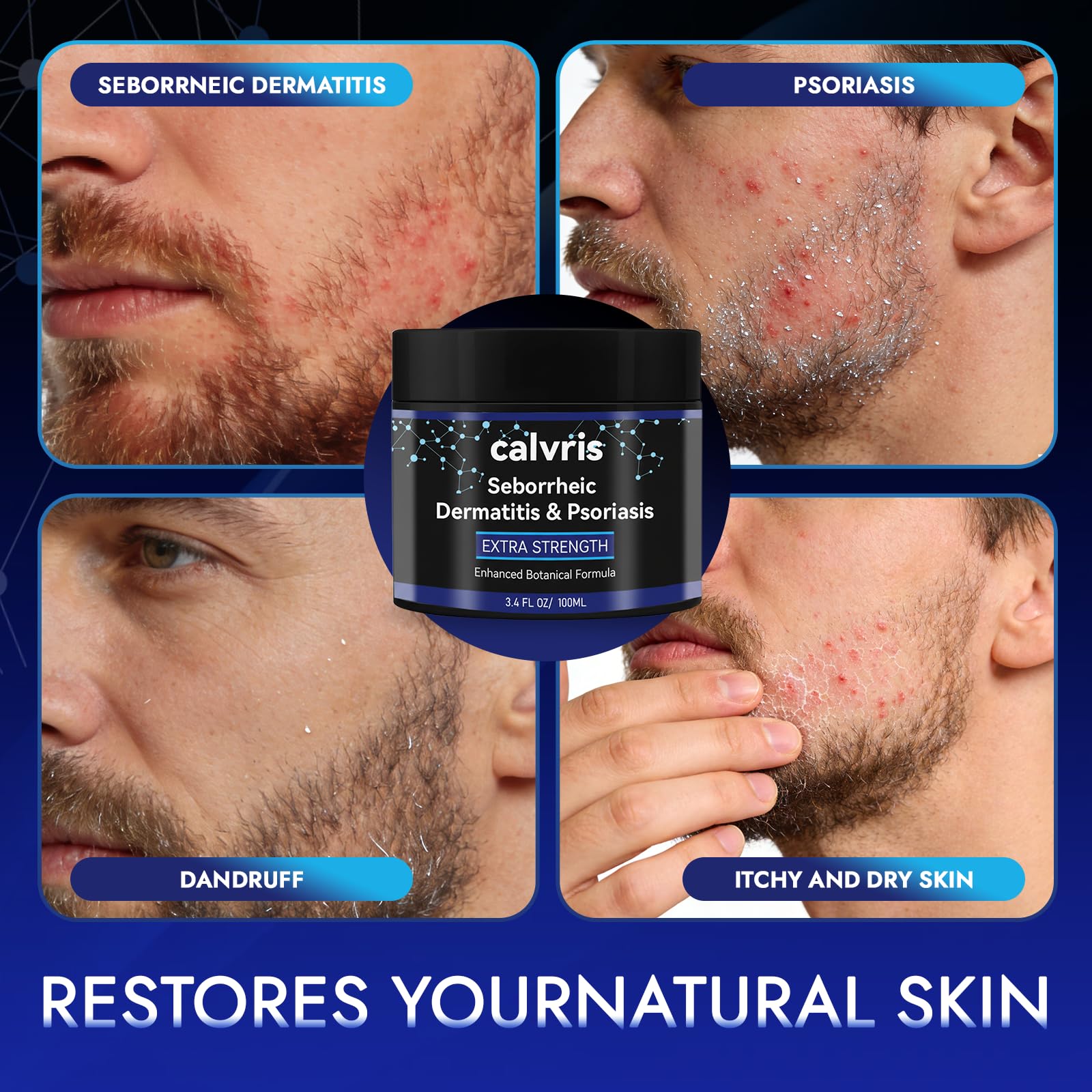 Calvris Crème confort cuir chevelu: pellicules et irritations atténuées