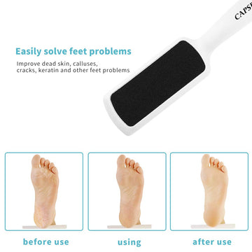 Capspace mango ergonómico ofrece agarre estable durante la pedicura