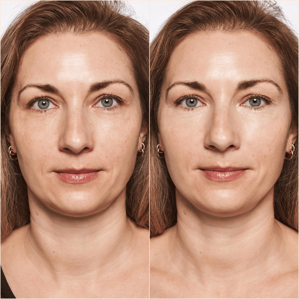 Catrice True Skin High Cover Concealer, cobertura de hasta 18 horas