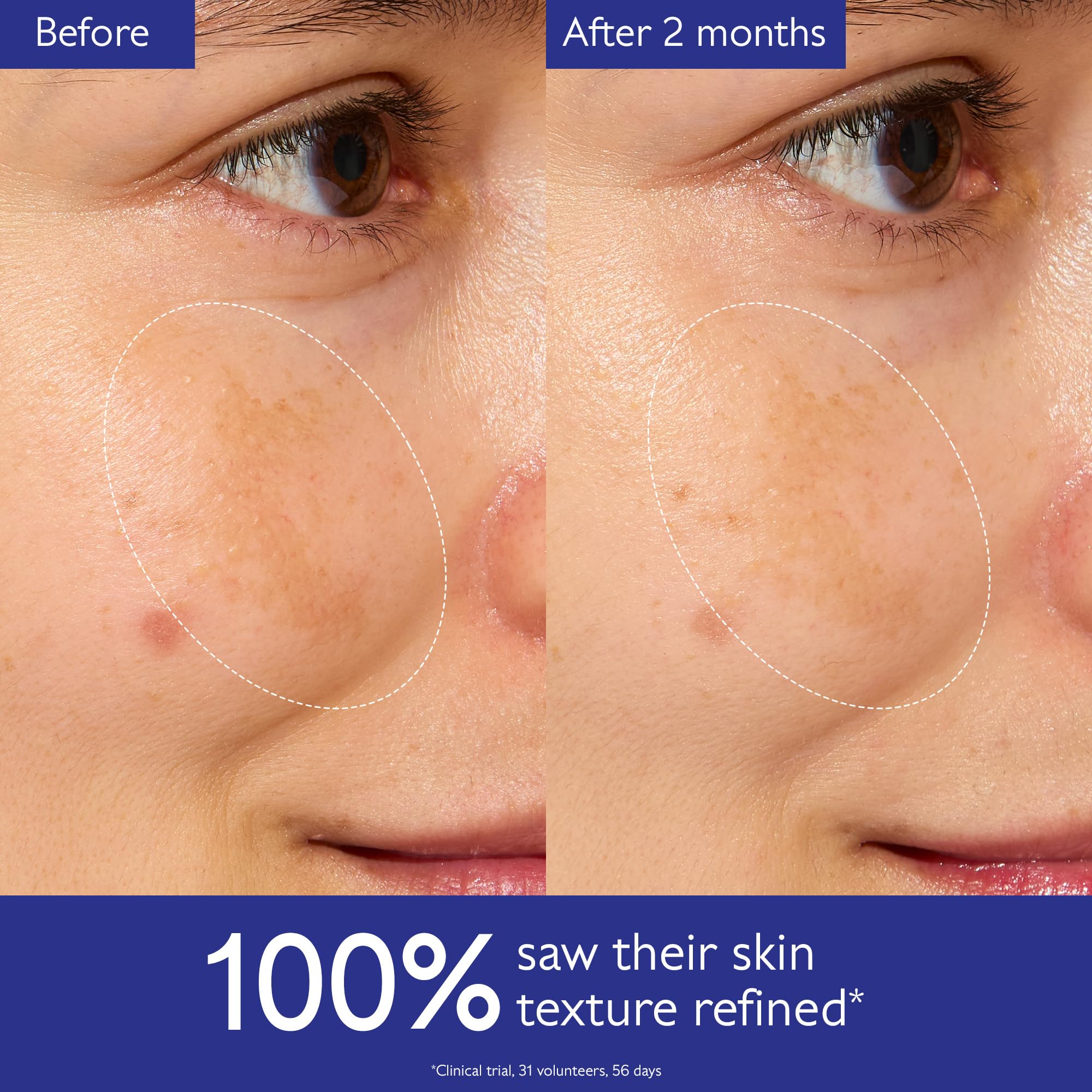 Caudalie Vinoperfect Esencia Iluminadora: gotas suaves para exfoliar ligeramente.