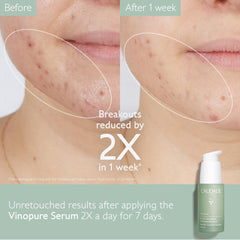 Caudalie Vinopure: exfoliación suave que refina textura de la piel.