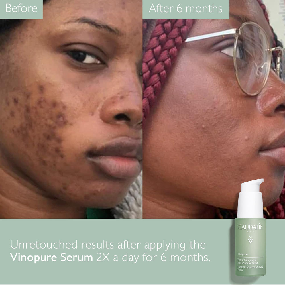 Caudalie Vinopure: polifenoles antioxidantes protegen la piel.