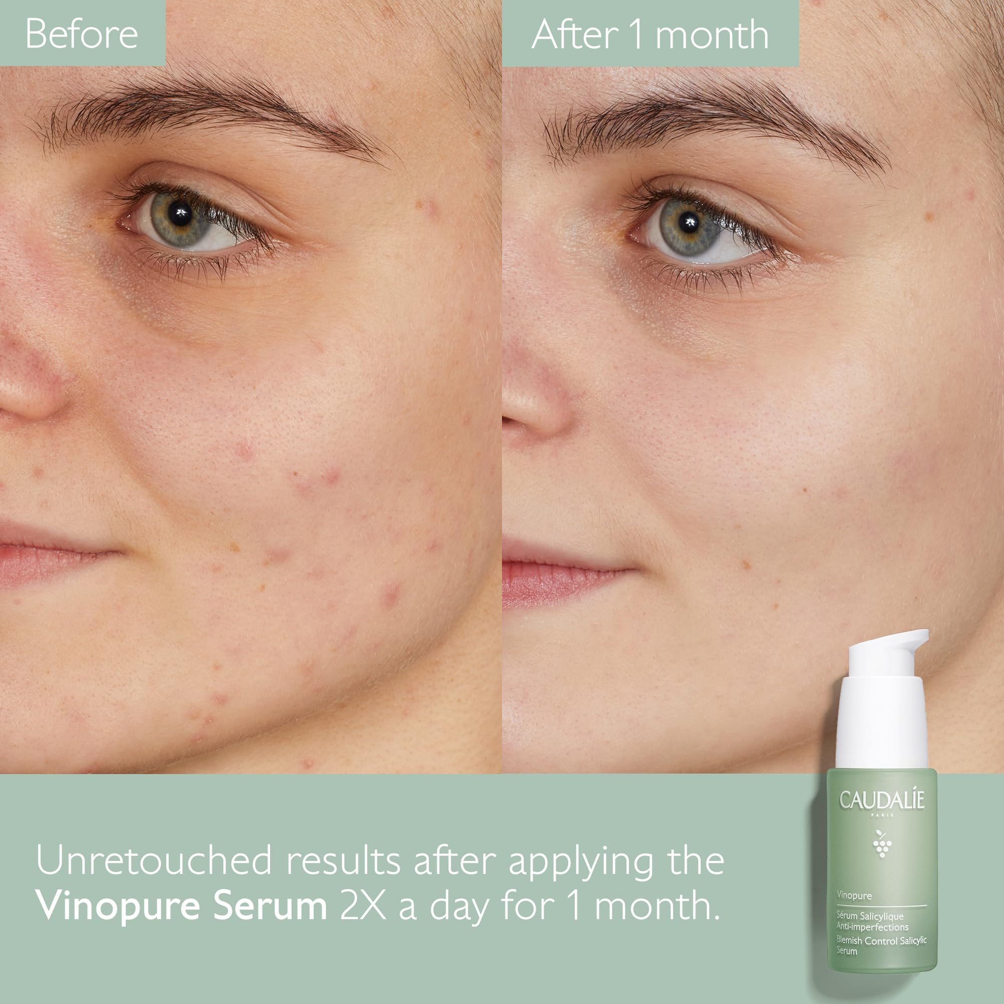Caudalie Vinopure: suero ligero que se absorbe rápidamente.