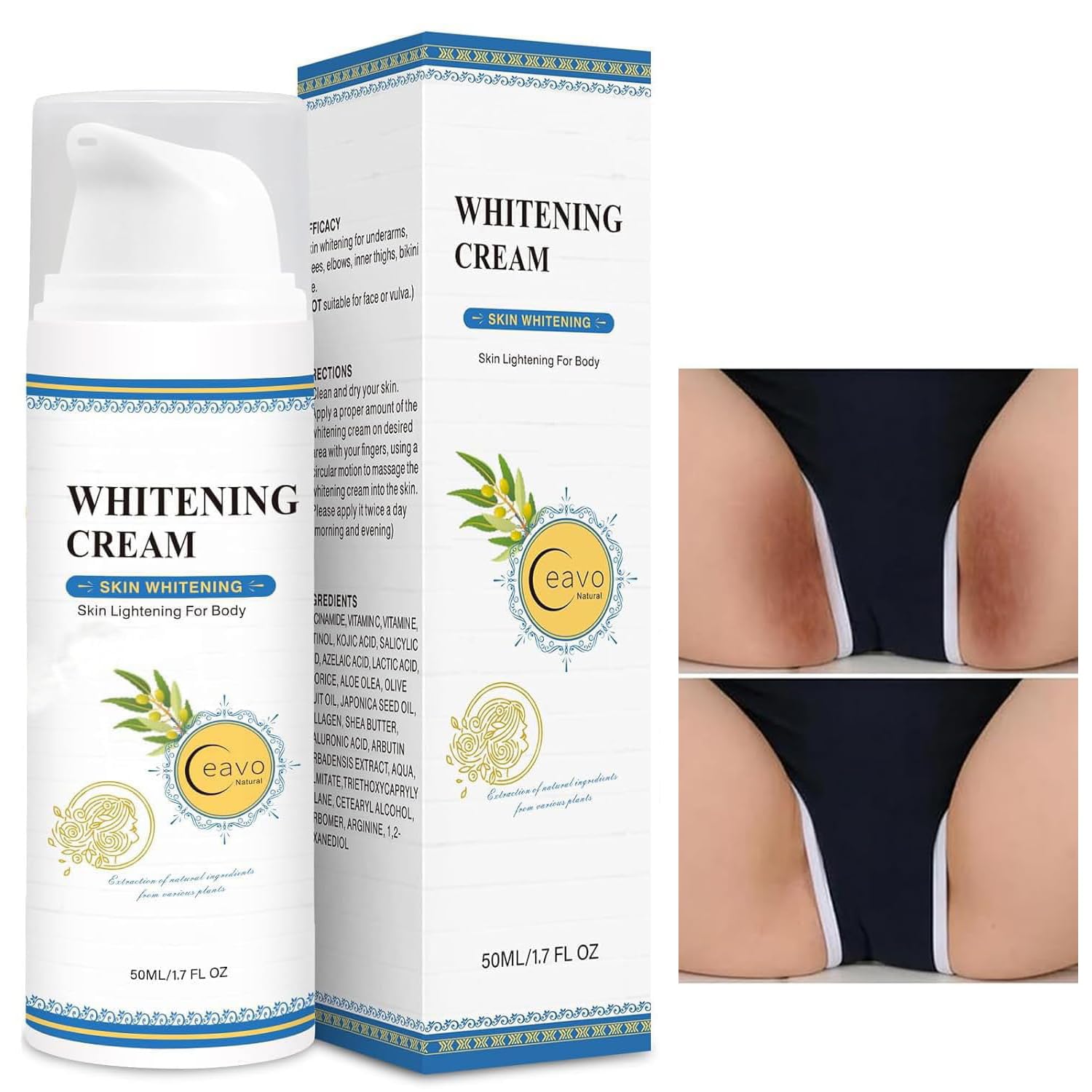 Ceavo crema aclaradora para áreas íntimas, tono más uniforme y suave