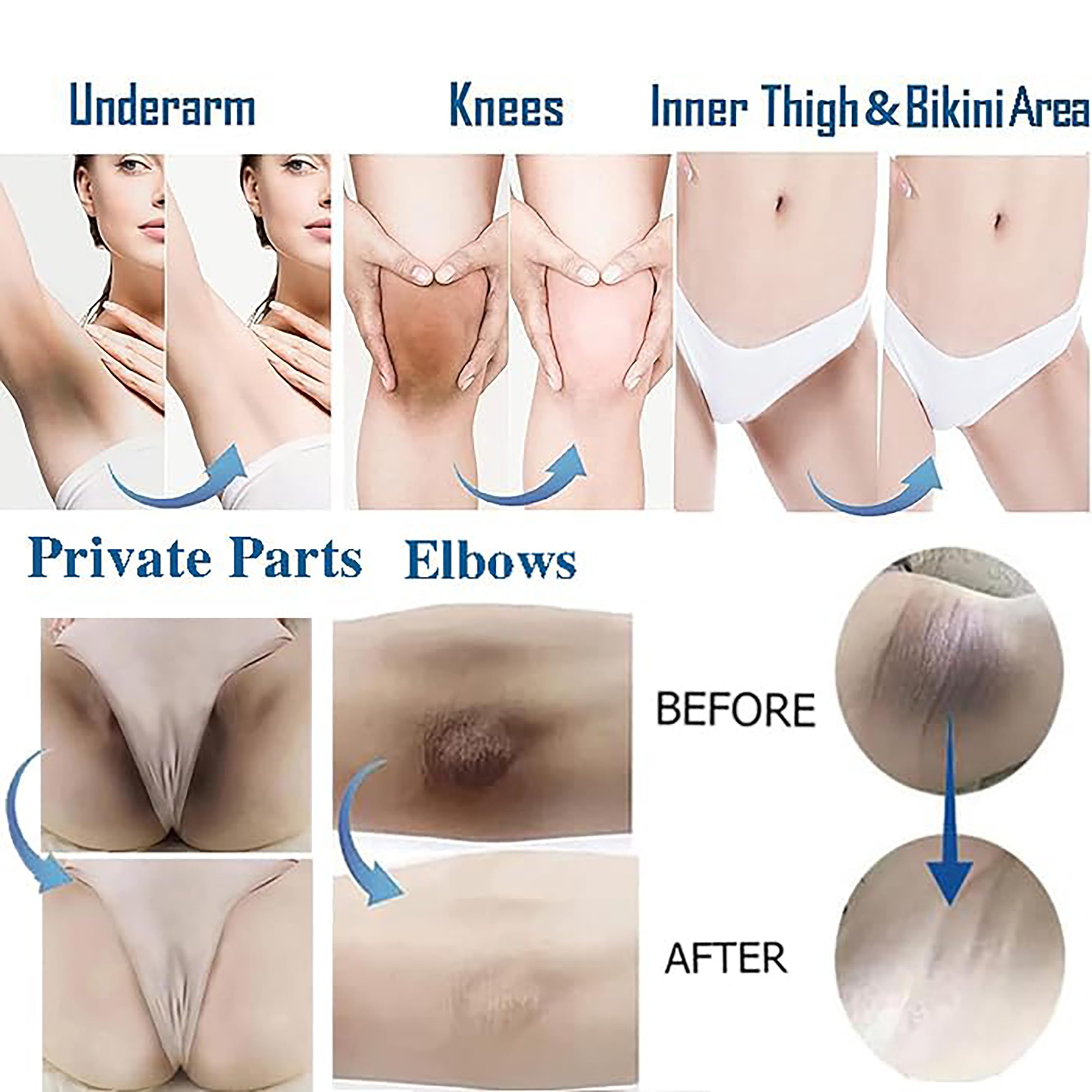 Ceavo crema aclaradora para axilas, piel más clara y tono uniforme.