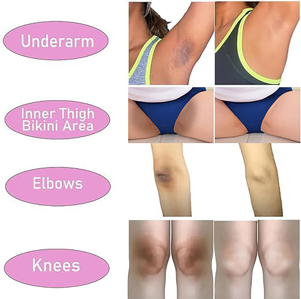Ceavo crema aclaradora para línea bikini, piel uniforme y suave.