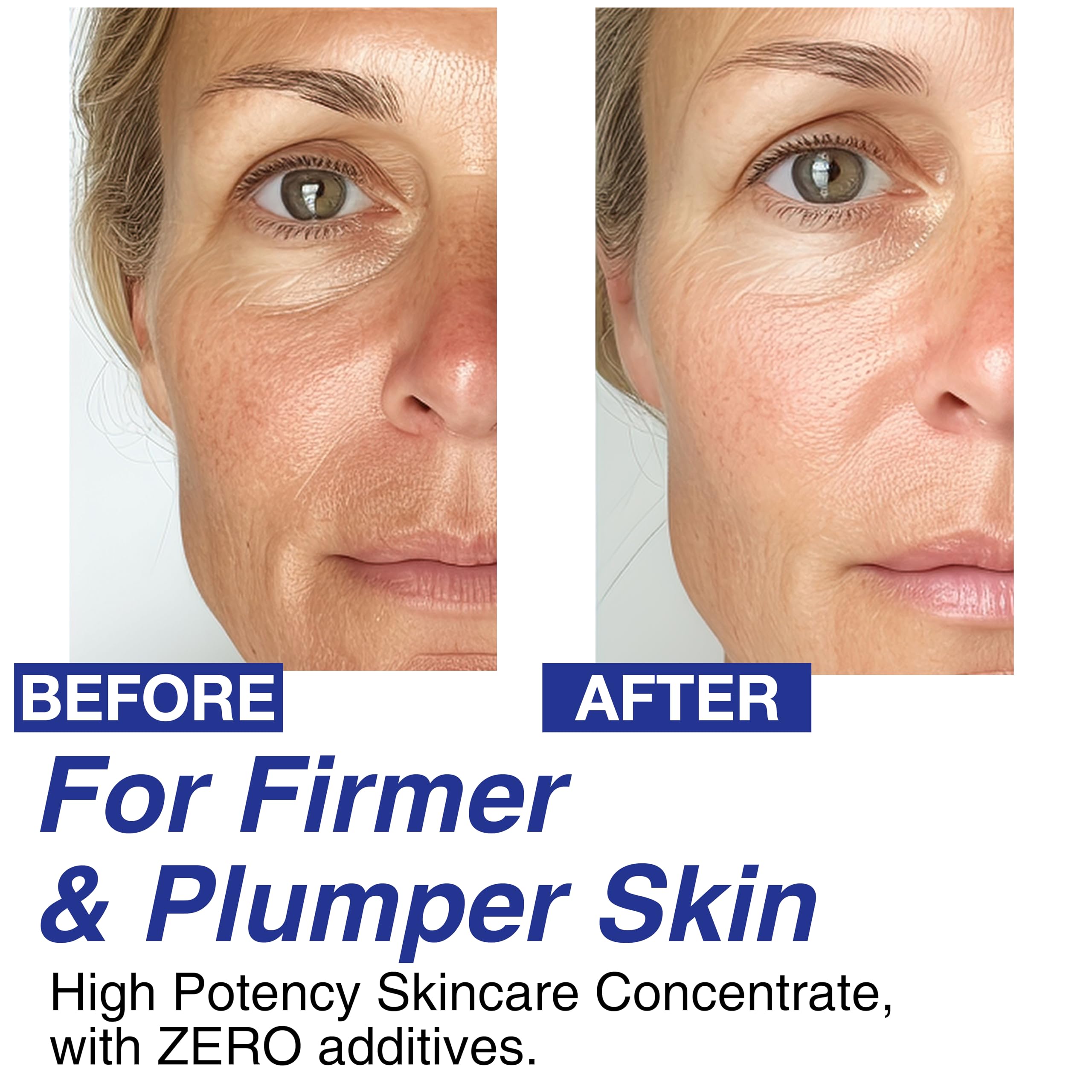 Celdyque Volufiline contorno mandíbula mejor definido para un perfil más nítido.
