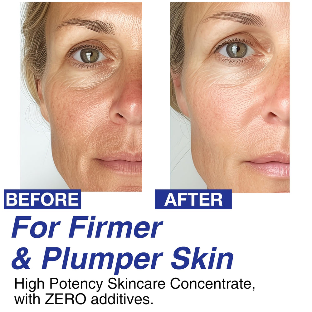 Celdyque Volufiline contorno mandíbula mejor definido para un perfil más nítido.