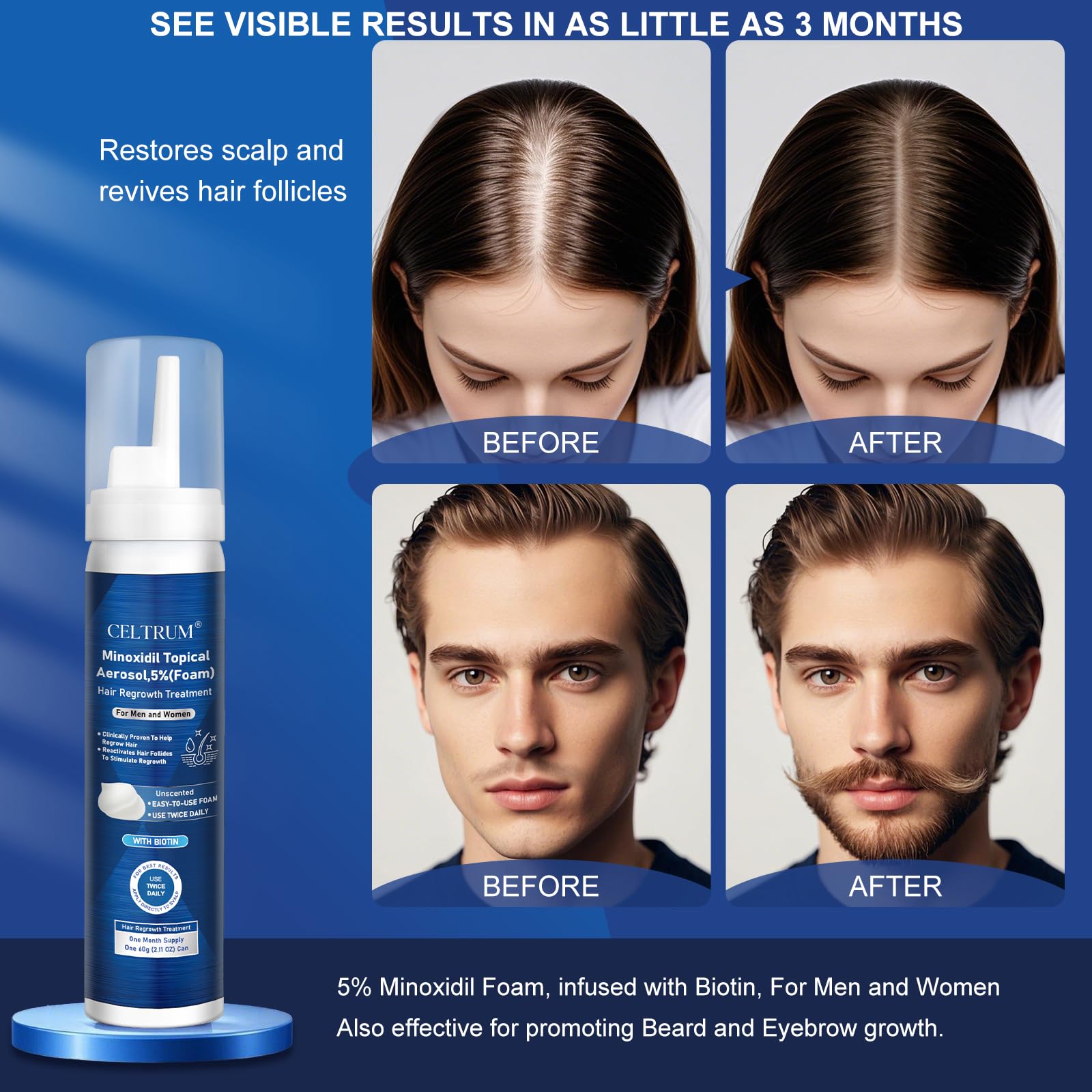 Celtrum application steps illustrate quick minoxidil routine.