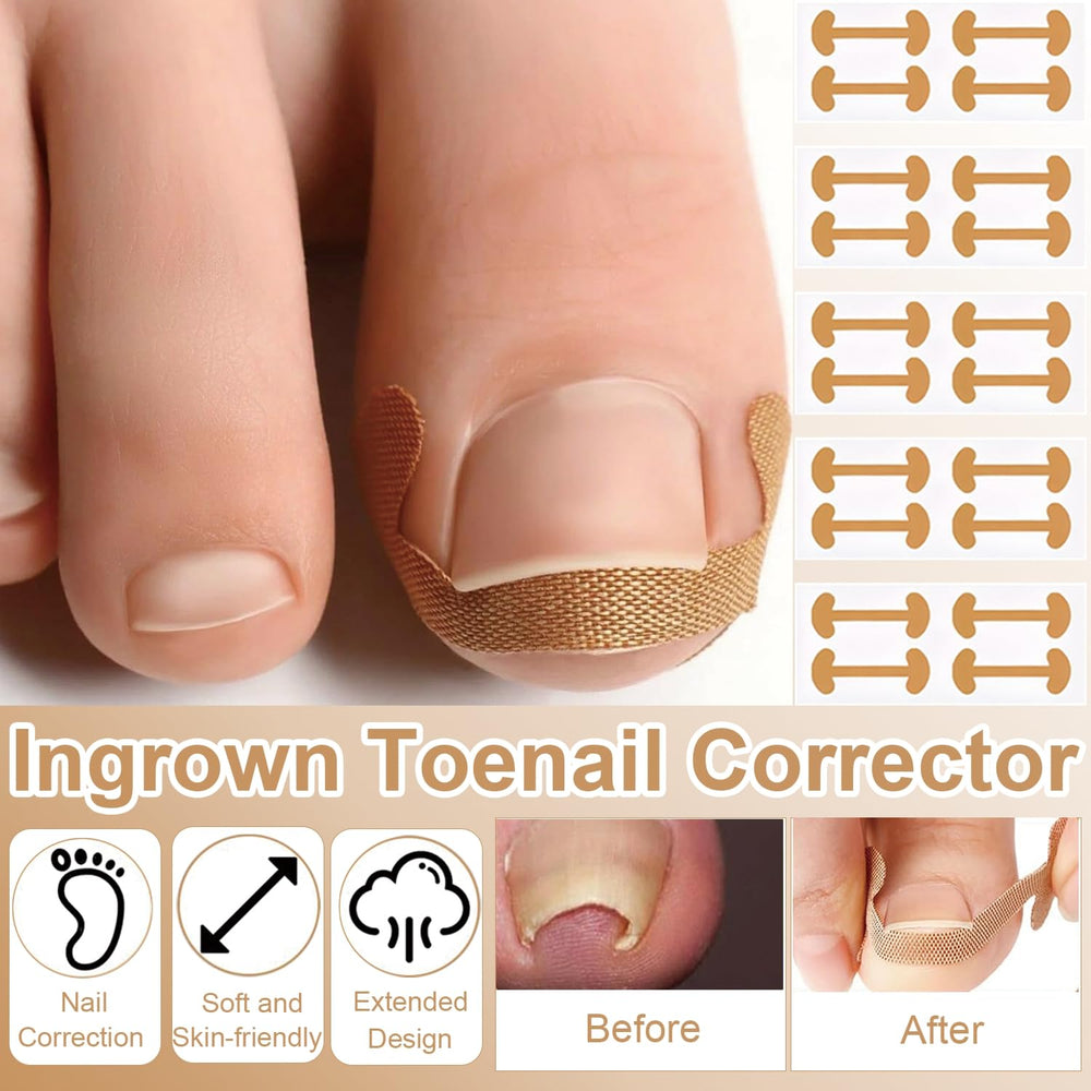 CESWEIAR parches-tela-no-tejida, material suave que reduce irritación.