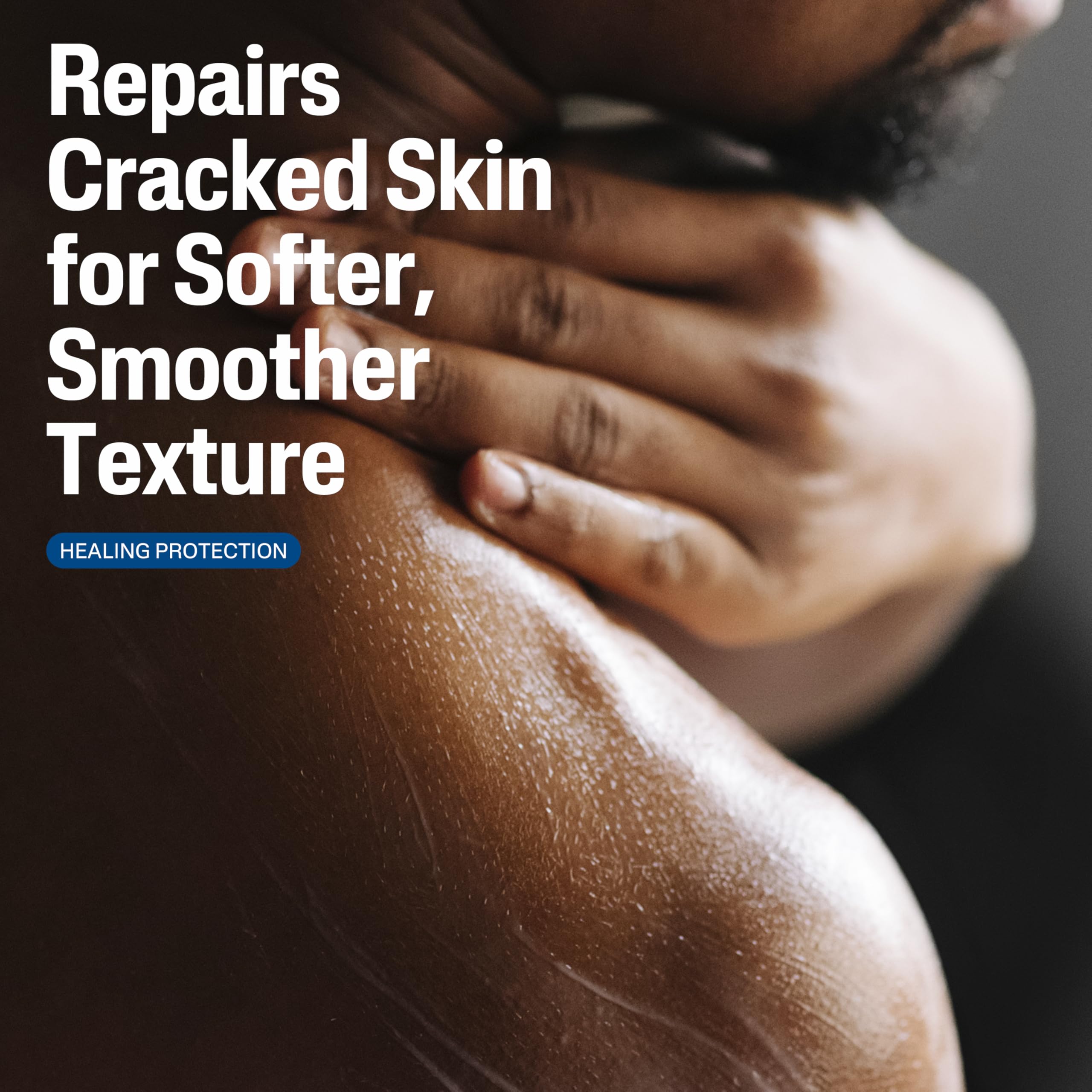 Cetaphil Cracked Skin Repair Lotion: aplicación en manos para hidratación tras lavados.
