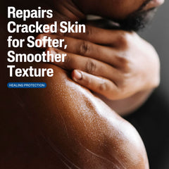 Cetaphil Cracked Skin Repair Lotion: aplicación en manos para hidratación tras lavados.