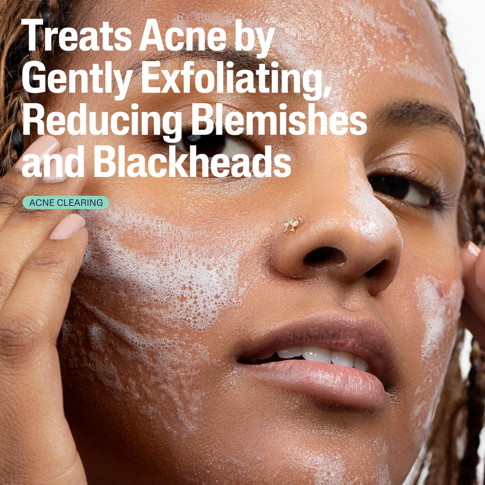 Cetaphil Gentle Clear foaming lather in hand for exfoliation