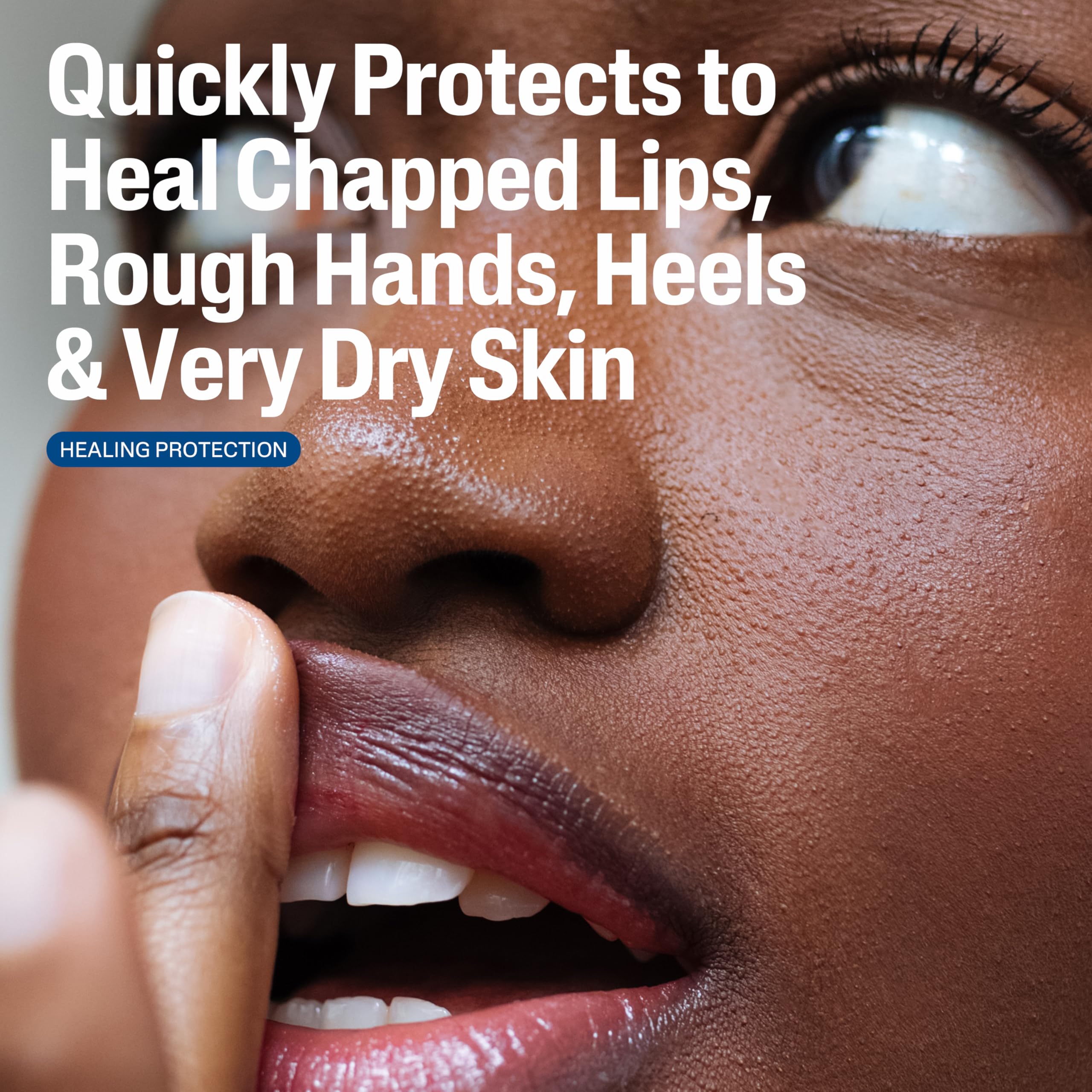 Manos secas y agrietadas mejoradas con Cetaphil Healing Ointment.