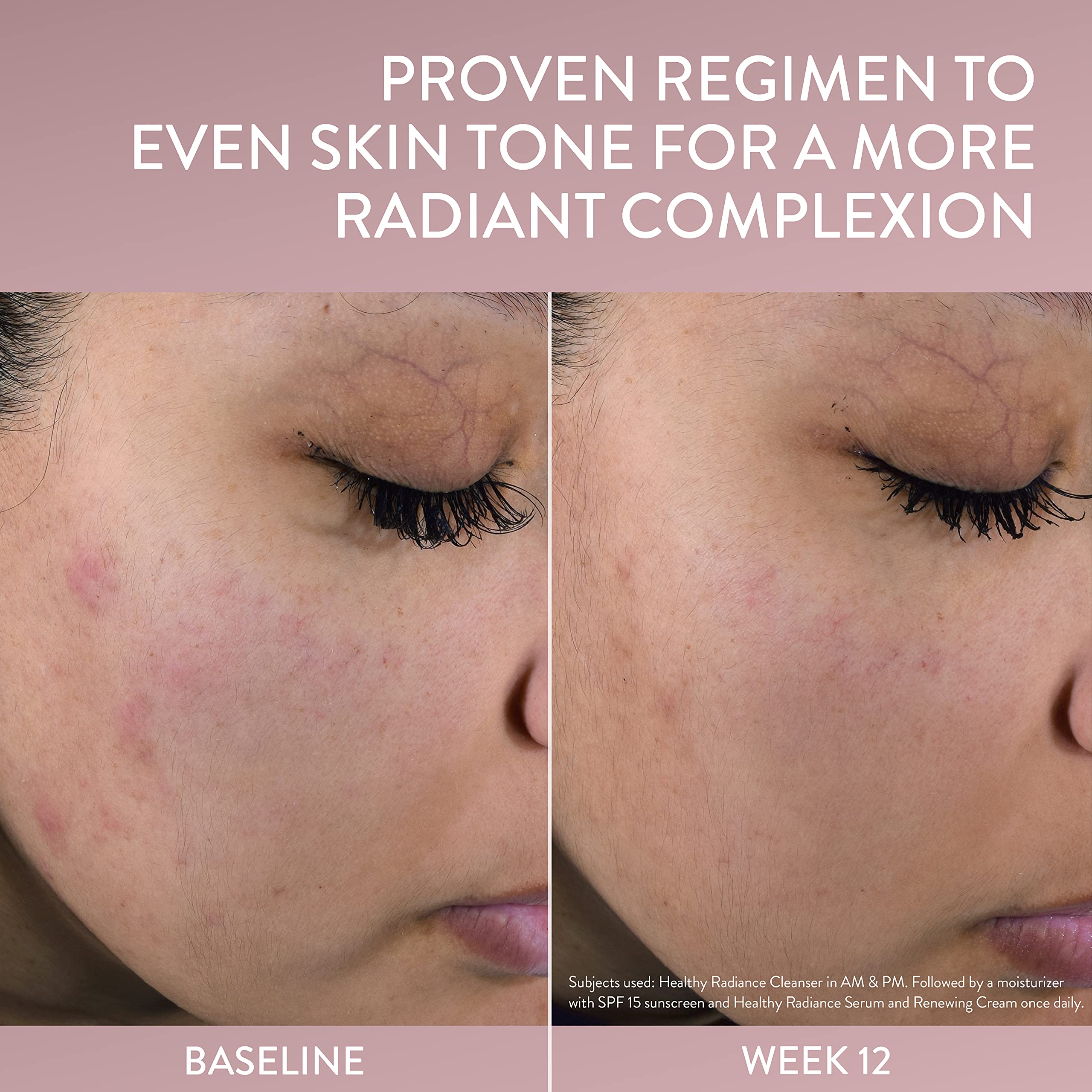 Cetaphil serum dropper visual for precise, clean daily use.
