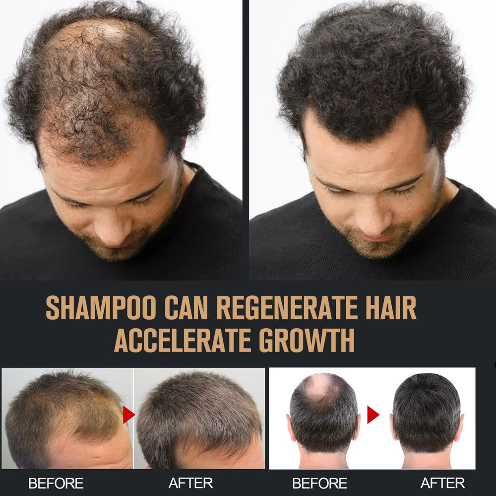 Champú Activador de Raíz: color natural y brillo sostenido