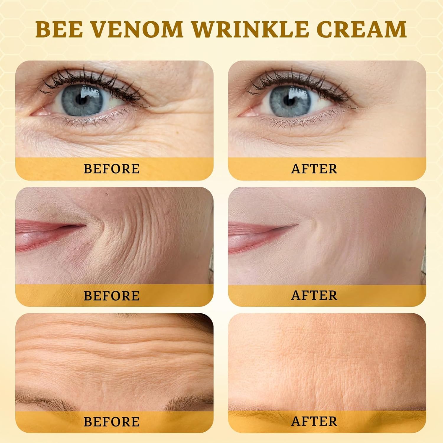 CHEOKINGBA crema veneno abeja cara y cuello con textura ligera