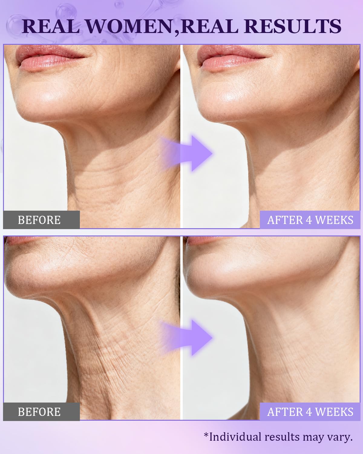 Retinol 1% CHEOKINGBA apoya elasticidad y contorno.