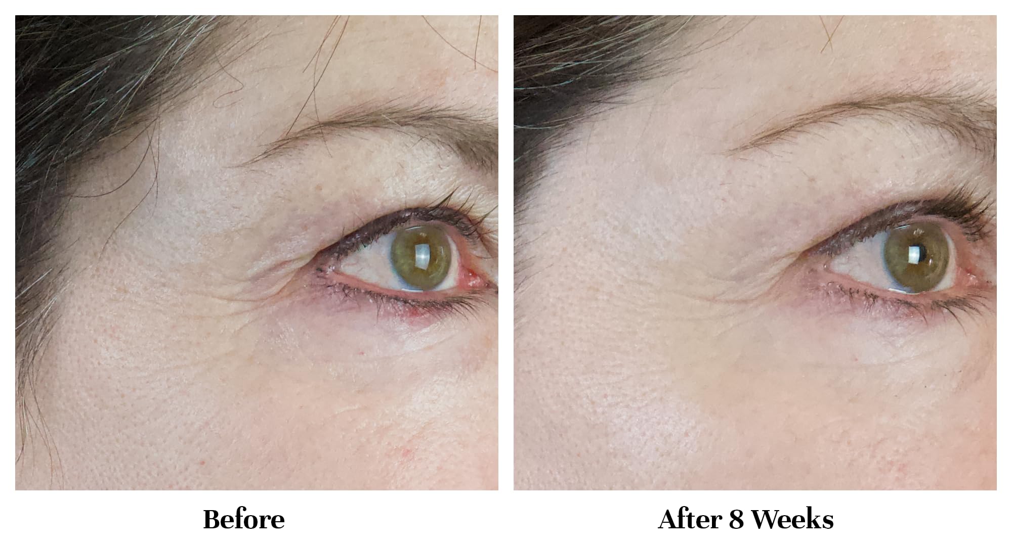 City Beauty Line-Blurring Wrinkle Filler zone yeux et lèvres en application ciblée