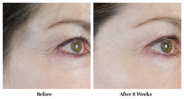 City Beauty Line-Blurring Wrinkle Filler zone yeux et lèvres en application ciblée