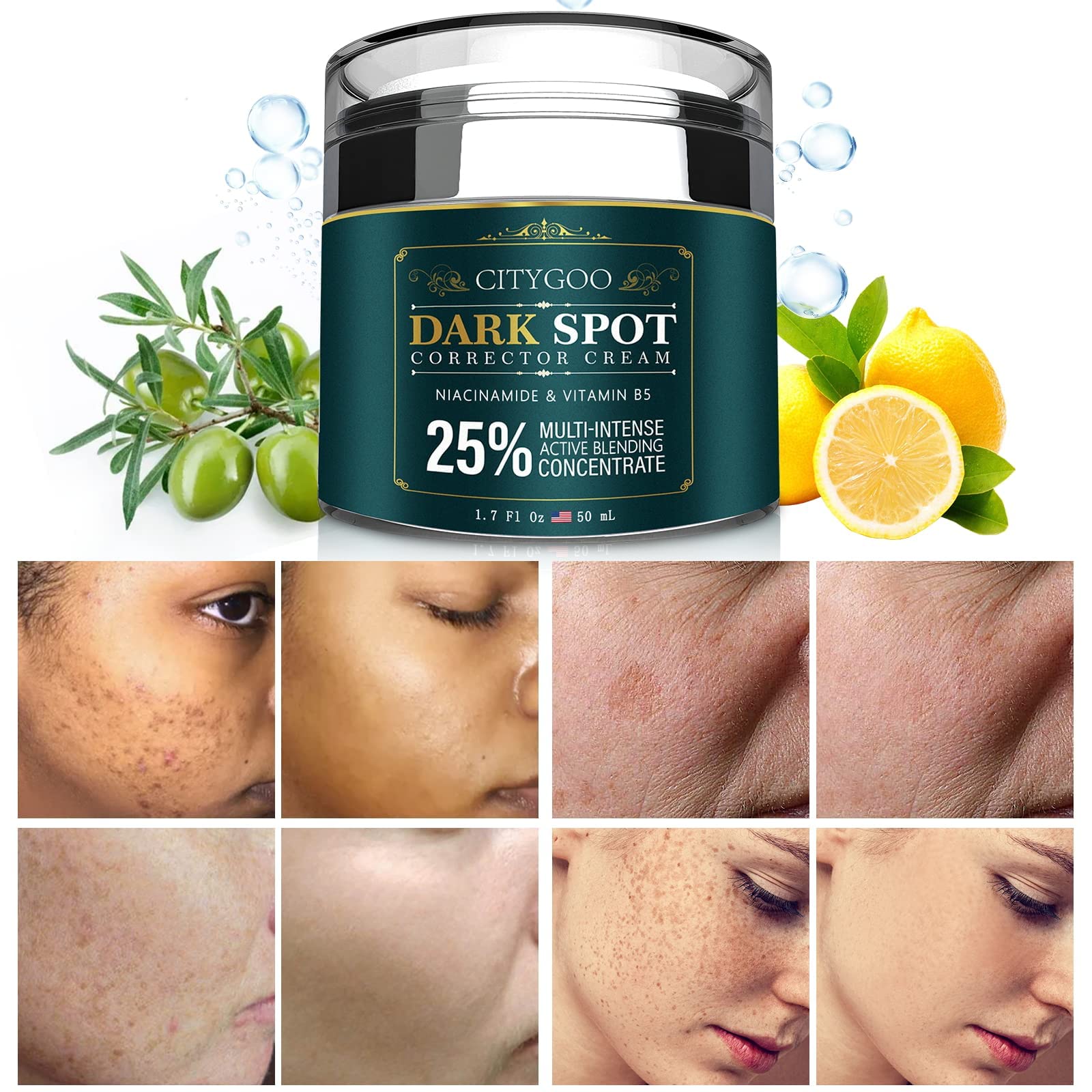 CITYGOO crema para manchas en rostro, envase en bote; uso diario suave y efectivo.