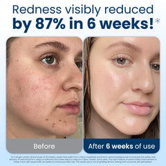 CLEAN SKIN CLUB Clean Towels XL: uso diario para secar el rostro sin fricción.