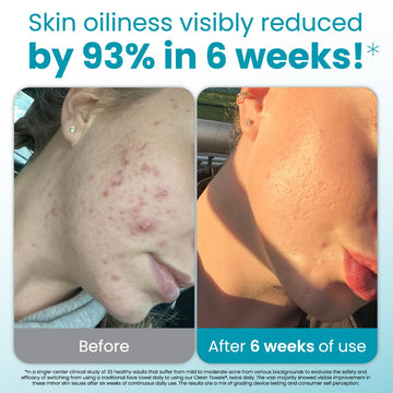 Toallas infundidas con aloe vera y glicerina Clean Skin Club para piel sensible.