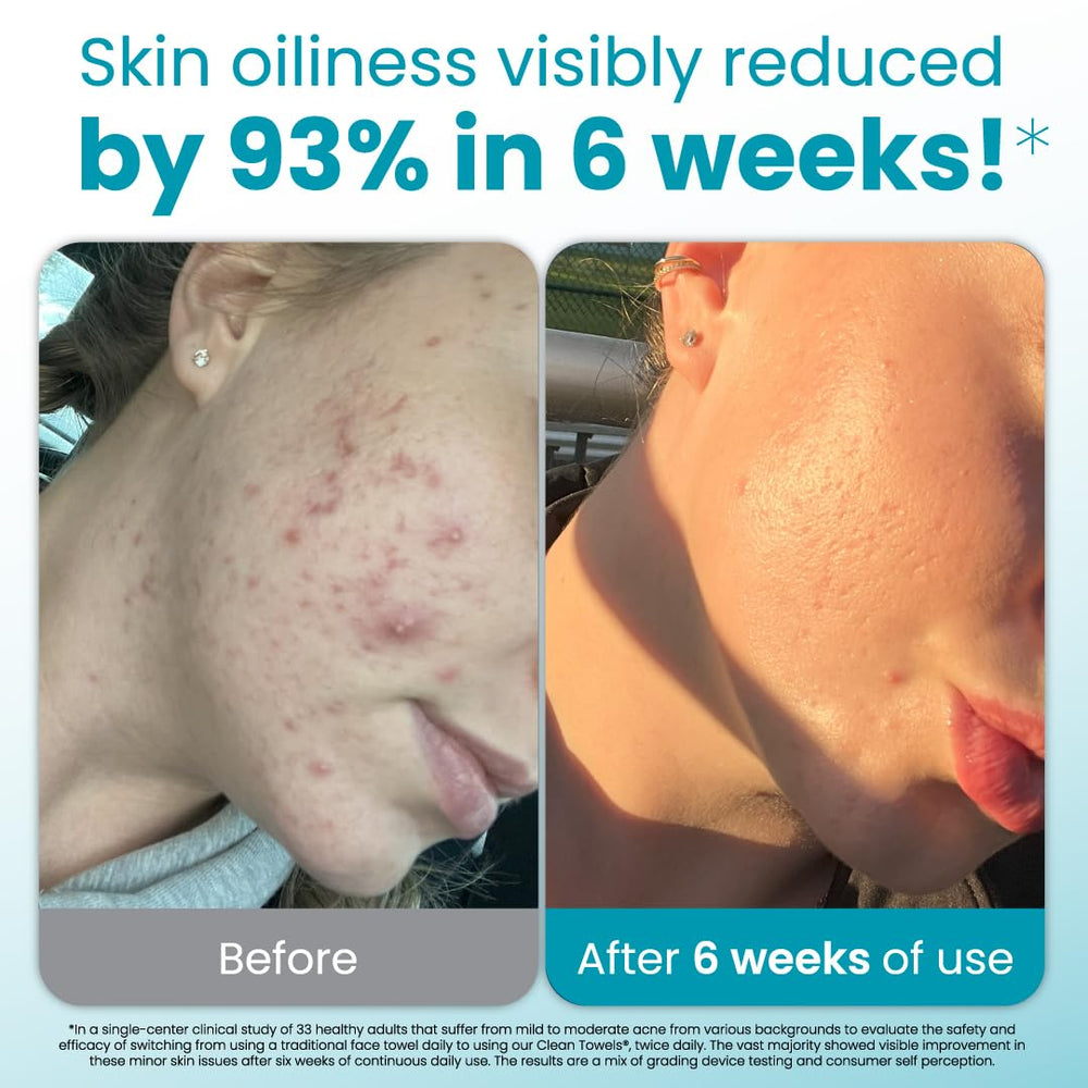 Toallas infundidas con aloe vera y glicerina Clean Skin Club para piel sensible.