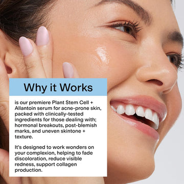 CLEARSTEM CellRenew: uso en rostro y cuello para hidratación.
