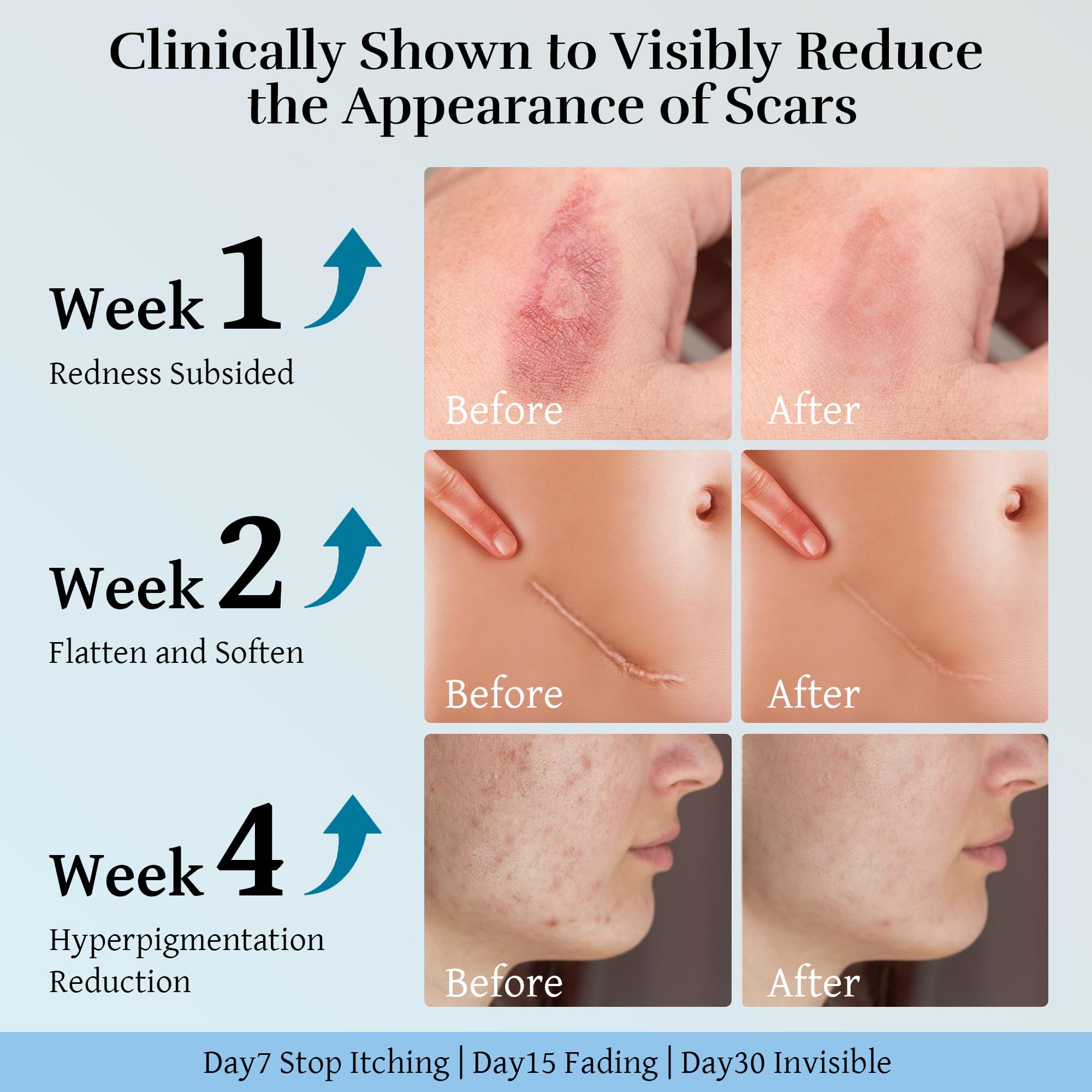 CLNABFR scar cream texture demonstrates easy absorption and skin-softening benefits