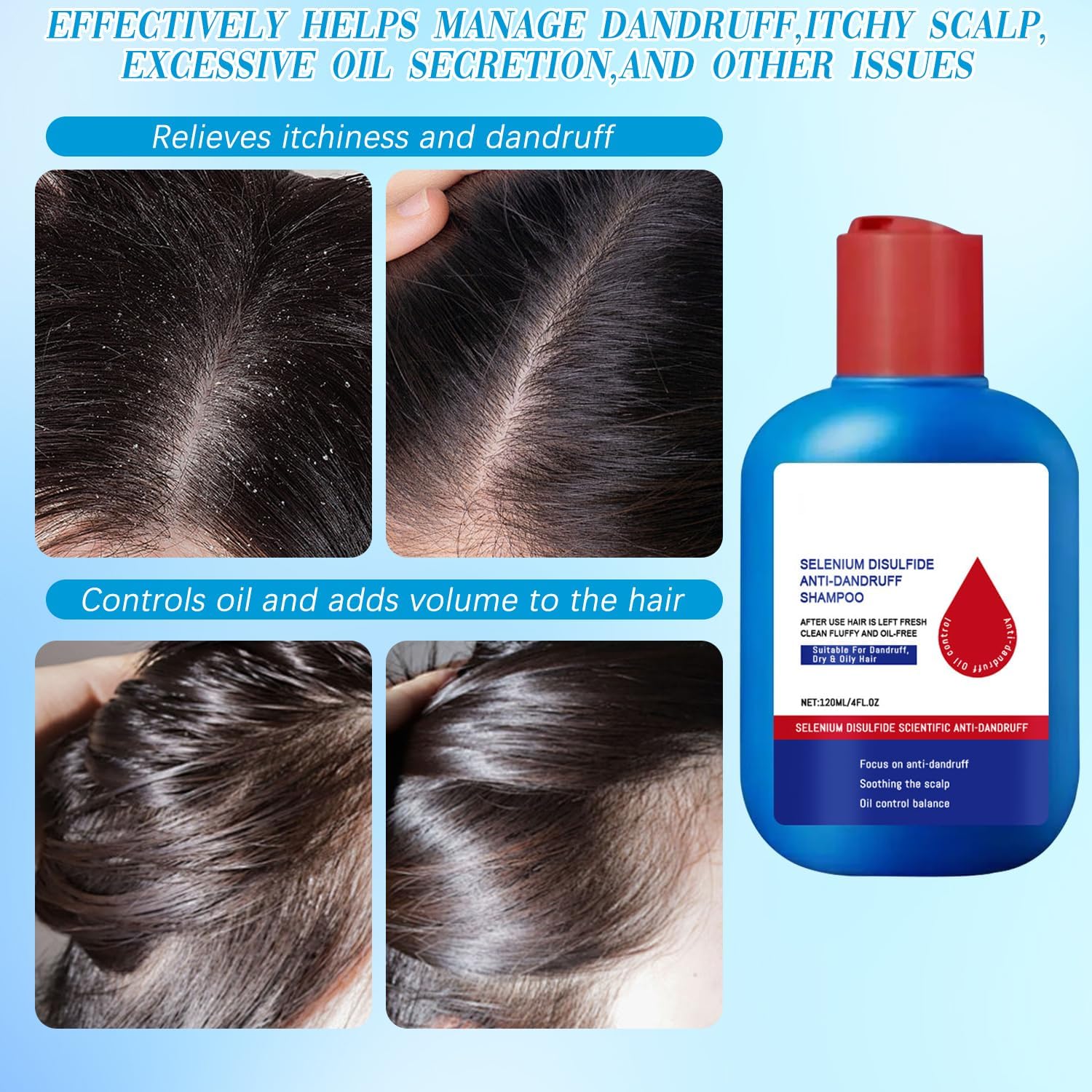 CLYXQP Limpieza Profunda de Cabello: limpia cuero cabelludo y hebras con cuidado.