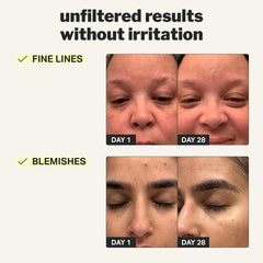 Aplicación nocturna suave del gel de retinol para piel sensible