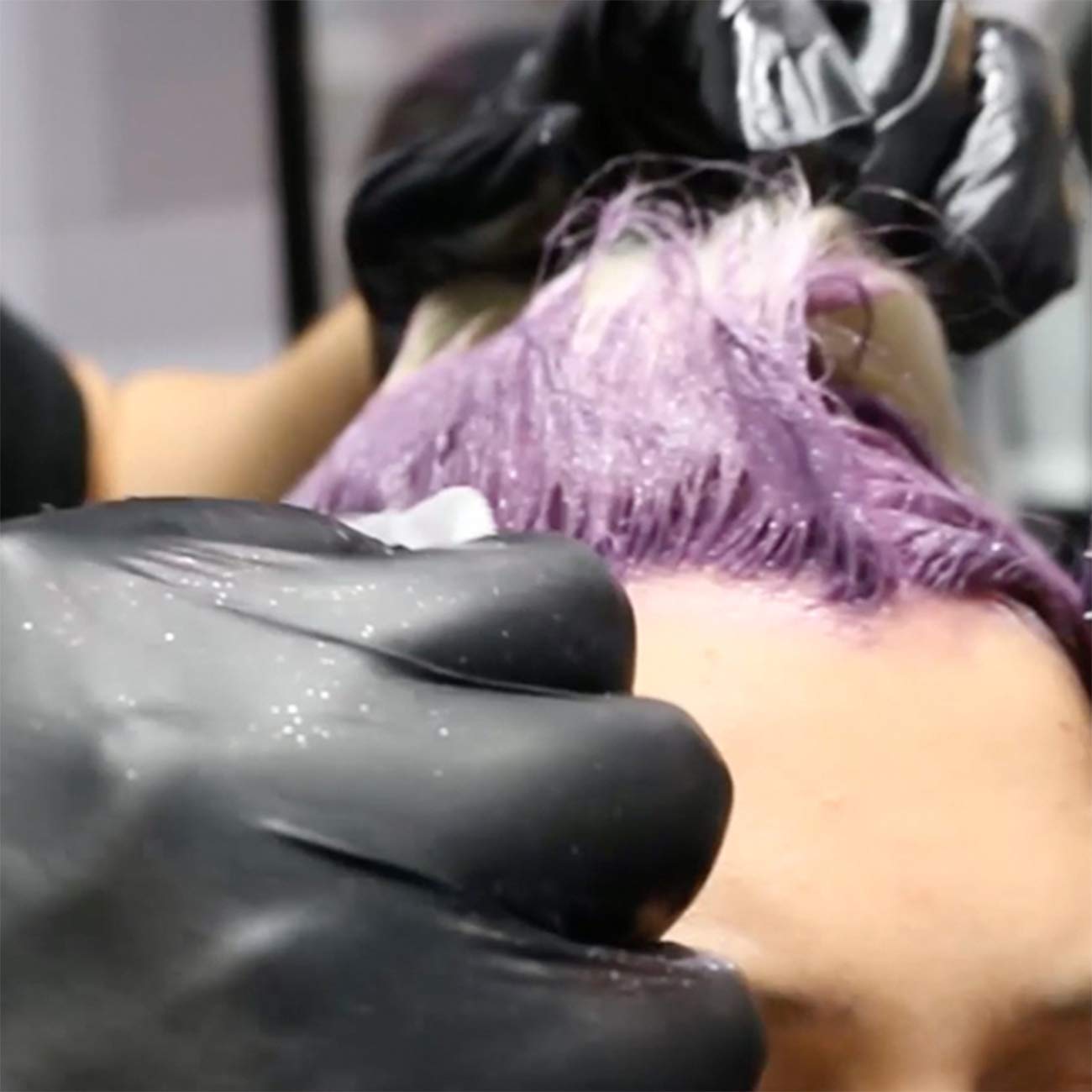 Remoción de manchas de color en piel con Colortrak para uso profesional en sesión.