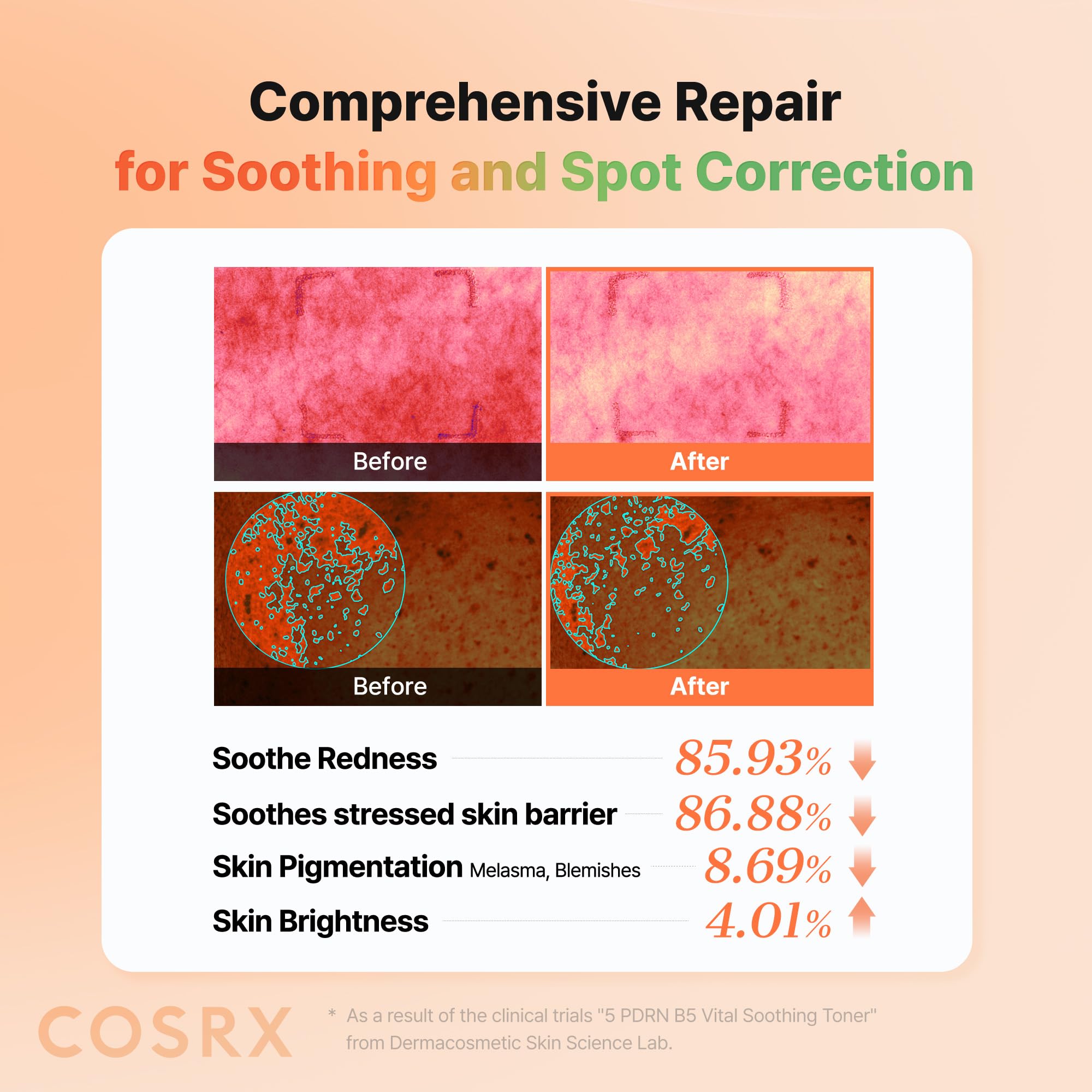 COSRX 5 PDRN B5 Toner, cierre-cap, sellado seguro para viajar.