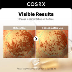 COSRX Alpha Arbutin, Niacinamida y Glutatión suavizan la textura de la piel.