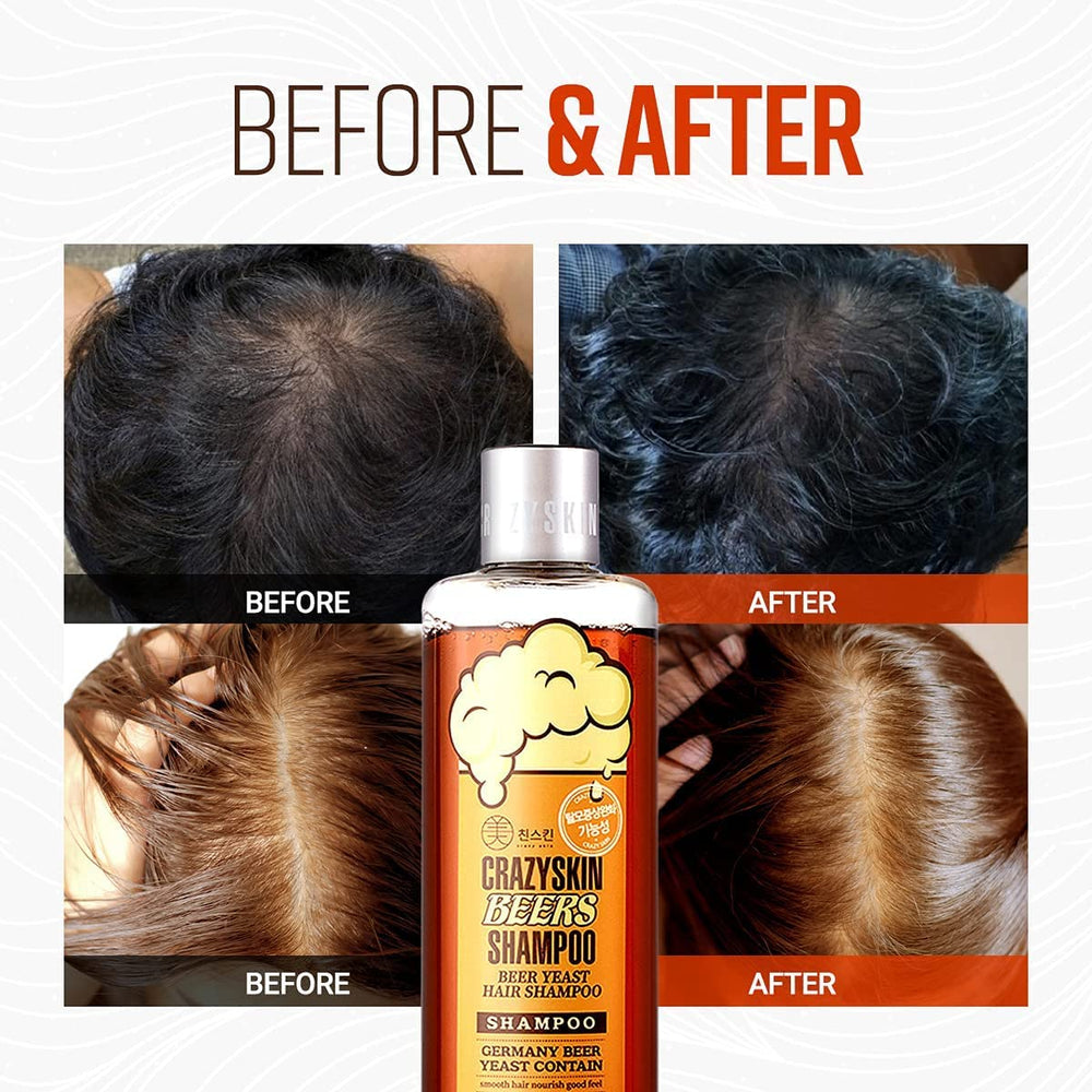 CRAZY SKIN Shampooing levure de bière – ingrédient vedette pour nourrir les cheveux.