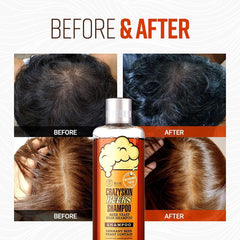 CRAZY SKIN Shampooing levure de bière – ingrédient vedette pour nourrir les cheveux.