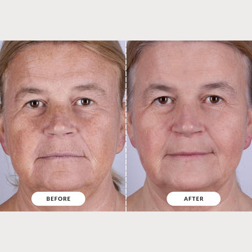 CurrentBody mascarilla LED Serie 2, tarjeta NFC Veritace, información personalizada sobre resultados.