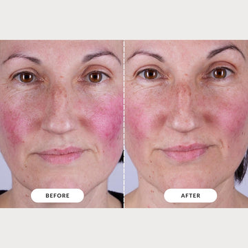 CurrentBody mascarilla LED Serie 2, uso recomendado en rutina de cuidado nocturno.