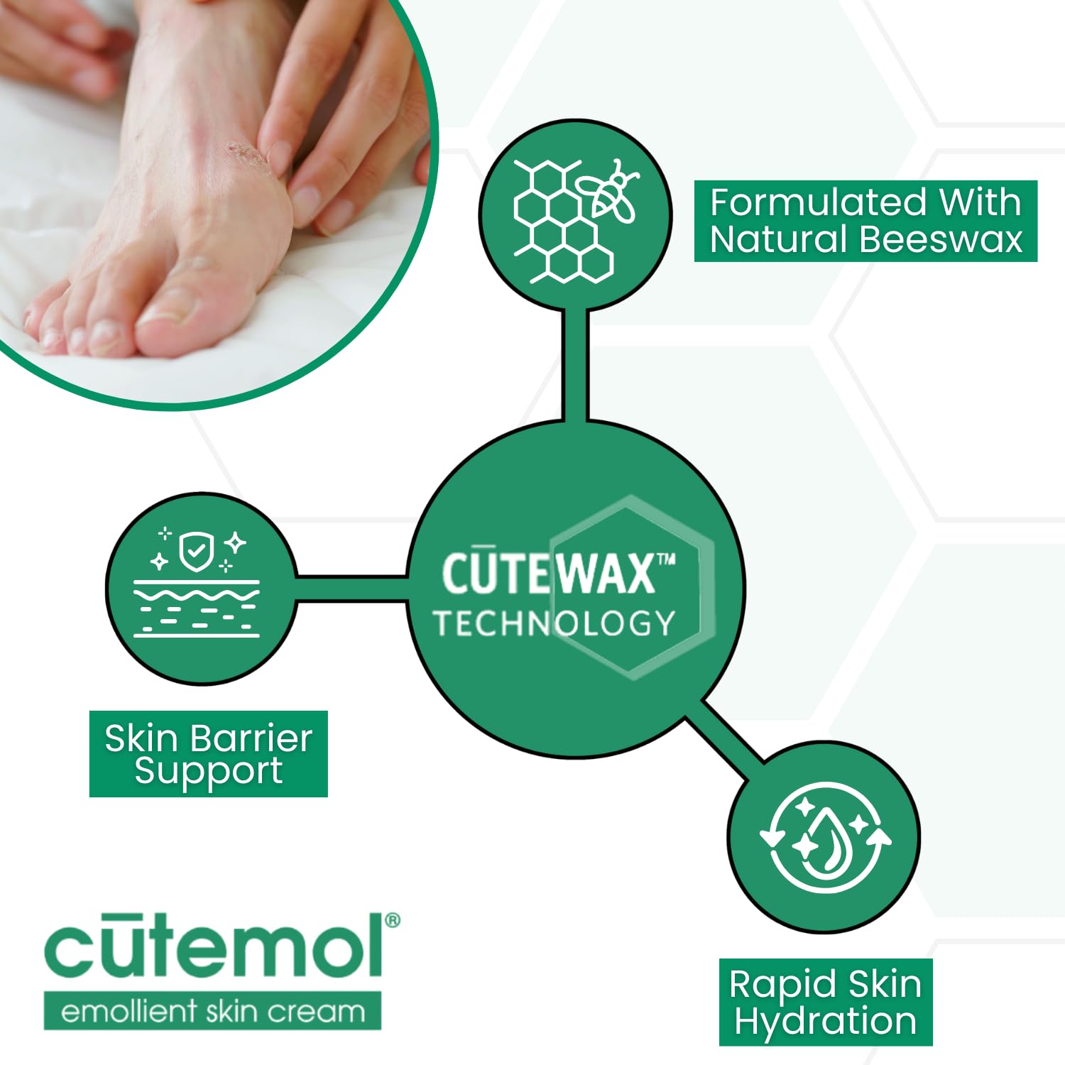 Cutemol pour eczéma et psoriasis – hydratation et confort quotidien.